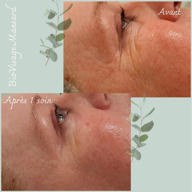 Soin BioVisage 6