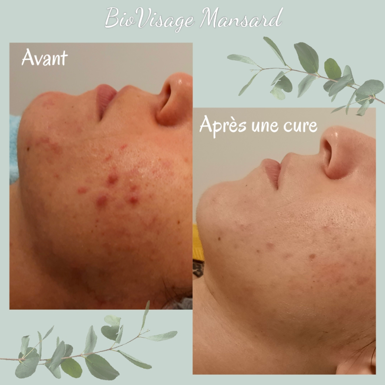 Soin BioVisage 7