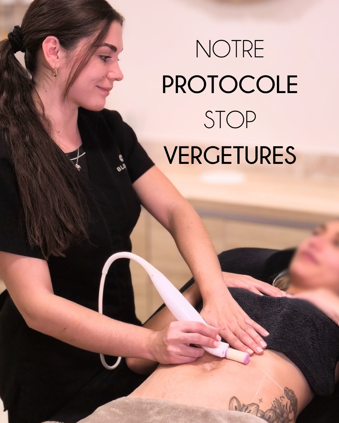 Mise en application du protocole correctif des vergetures Bloomea