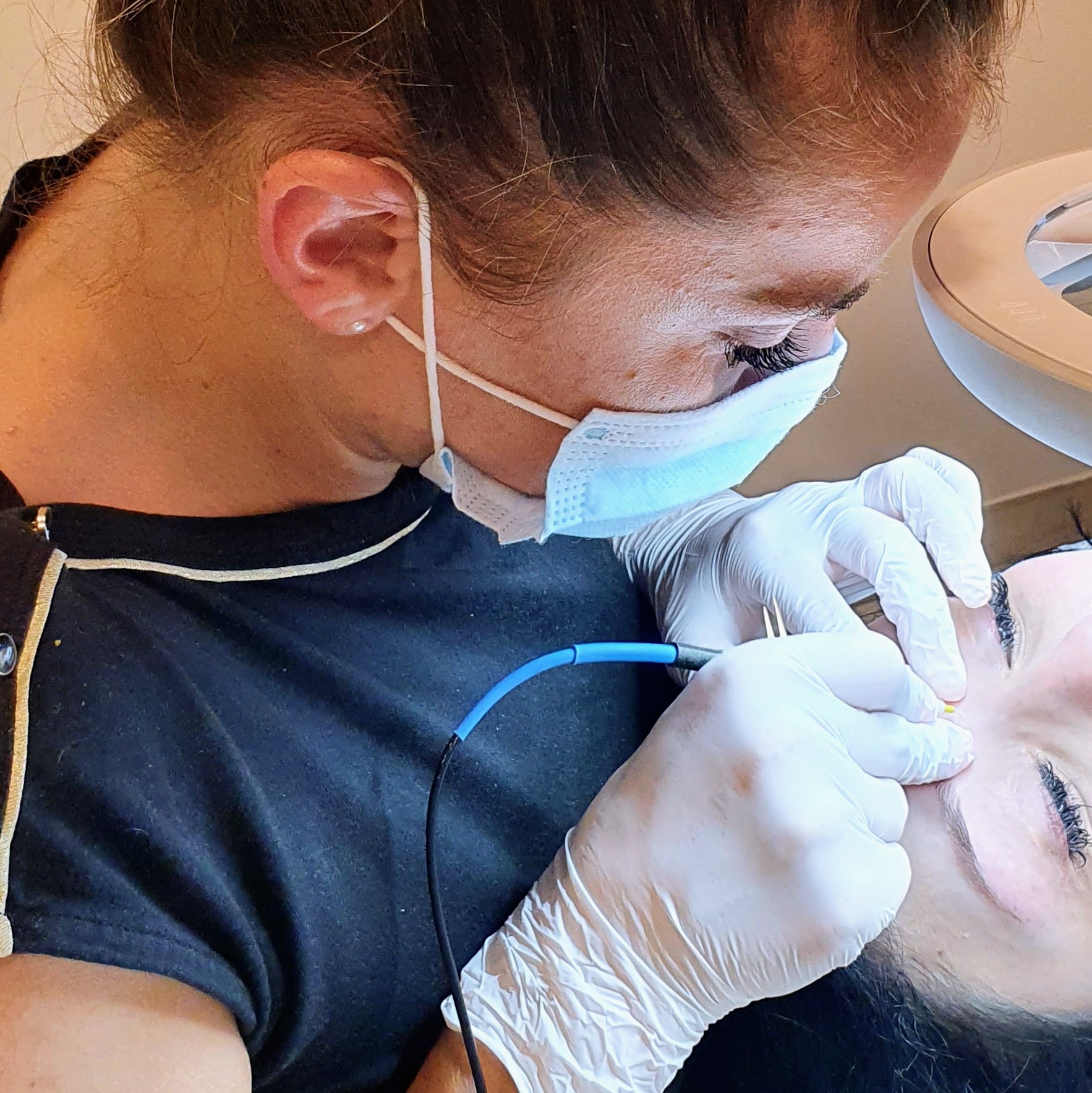 epilation définitive oreilles